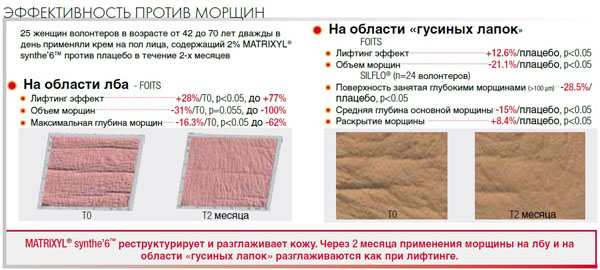 matrixyl 3000 что это