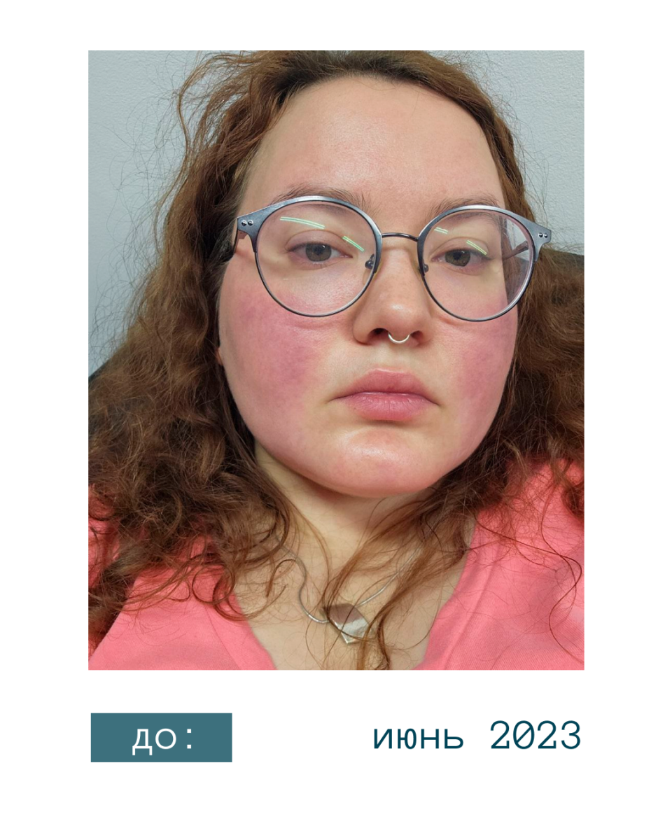 До применения